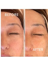 ラヴィン/セルキュア