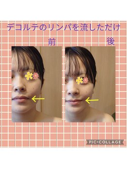 リベラ(LIBERA)/座位で首のリンパを流しただけ