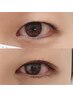 13160→12660【二重整体+ヒト幹細胞】まつげが細くて短い、まぶたが重たい方