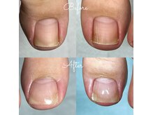 ランランネイル(rangrang nail)の雰囲気（巻き爪の痛みはその日から改善、見た目も綺麗な補正技術です）