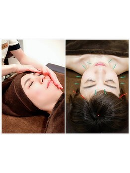 小顔になりたい