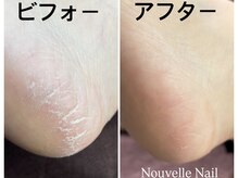ヌーベルネイル(Nouvelle Nail)/足裏角質ケア