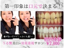 ホワイトニングショップ 多摩店