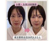 ローズモモの雰囲気（★本気で小顔・リフトアップを求める方へ結果重視の小顔矯正です）