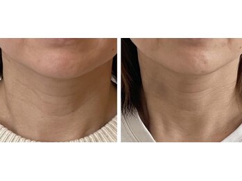 エレミュー(Elemue)/首元のエイジングも◎