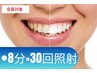 【褒められる白い歯に!】セルフホワイトニング8分×30回照射49800円