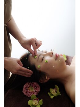 サラン鍼灸院(SARAN都楽鍼灸院)/美容鍼灸