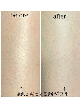 イーストモア(EAST MOIS)/自己処理の回数が減りました！！