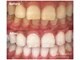 ハイティース 高田馬場店(Hi Teeth!)の写真