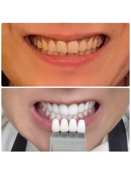 ワイズサロン(Y's salon)/継続すると!!