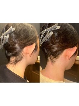 銀座シノ 灯 HANARE(shino)/襟足のお悩みご相談ください