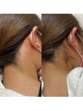 アリシア ビューティーサロン(Alicia)/ツルツル♪うなじワックス