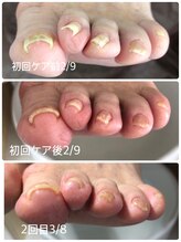 シェリエット(Cheriette)/