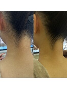 スイ 四条烏丸(SUI)/うなじもすっきり