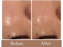 サロンドフェイス 木曽川店(Salon de Faith)/毛穴改善♪