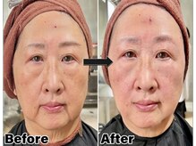 圧倒的な即効性と持続力、引き締めるだけのケアでは叶いません