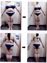 リラクゼーションサロン養舒閣/そう身