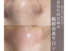 ニコラフ(Nico laugh)/