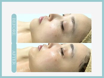 スリムライン 弘前店(The Slim Line)/before→after