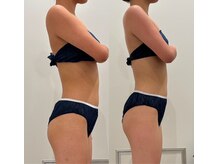 女神デトックス　長野店 【2月上旬 NEW OPEN（予定）】の雰囲気（【結果重視】特殊なジェルで脂肪＆体の有害物質排出！痩身効果◎）