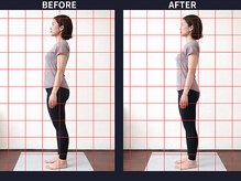 さいとう治療院 新百合ヶ丘/反り腰・骨盤のゆがみ