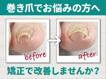 牛久巻き爪センター