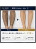 メンズ◇ひじ下甲指脱毛YUIMARLのお客様★お試し限定価格¥8800→