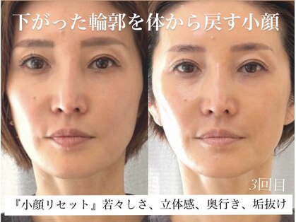 グラースア(grace a)の写真