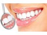 歯のセルフホワイトニング(2回照射)