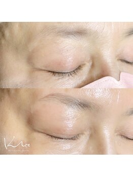 クレー(Klee)/アイブロウリフト