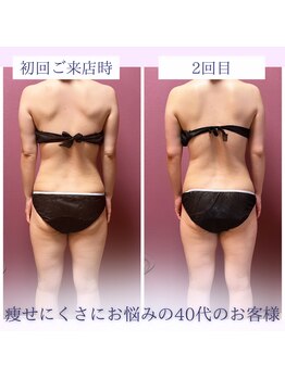 ビマリア(美-MARIA)/美BODY痩身リンパ