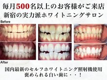 ラブホワイトニング 新宿店(LOVEホワイトニング)