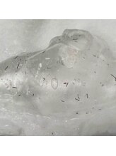 アウラ(AURA)/おヒゲの飛び出した毛です！