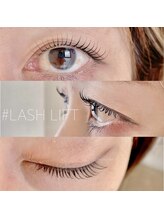 ステラ プラス(stella+)/ラッシュリフト