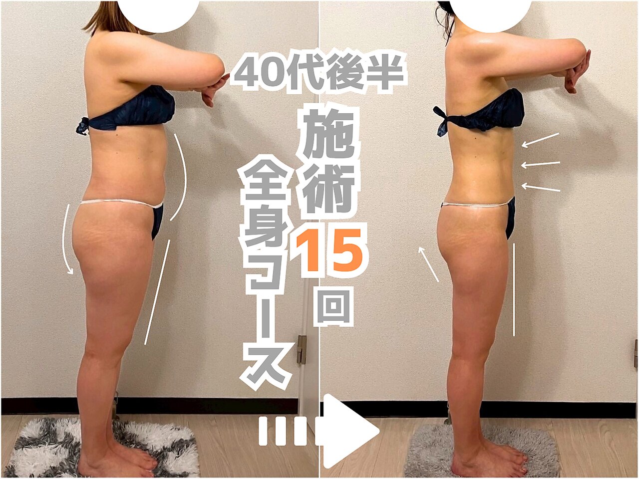 ティセラ(TISERA.)｜ホットペッパービューティー