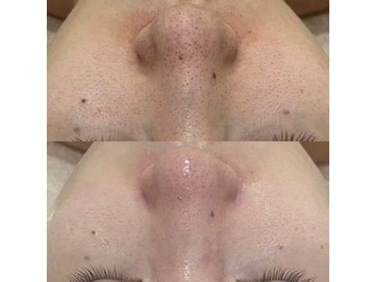 リンダ(Rinda)の写真