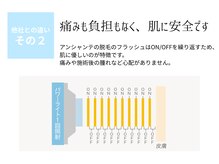 ピュアノア 三木店/脱毛　三木/小野/西脇/加東/加西