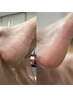 【フット】角質ケア(お爪のカット・ケア／かかとの角質ケア）￥5,000