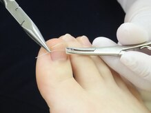 ドクターネイル爪革命 苫小牧店の雰囲気（巻き爪ケアで負担の少ない爪へ♪）