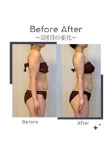 ミービレイ(Mie美戻)/ビフォーアフター