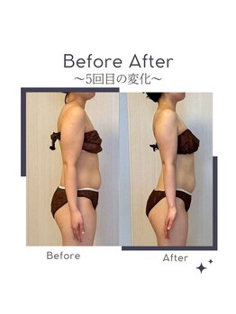 ミービレイ(Mie美戻)/ビフォーアフター