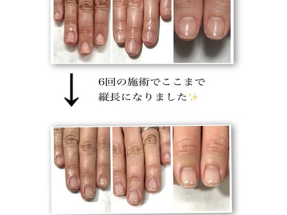 ネイルサロン ピーアンドビー(P&B)の写真