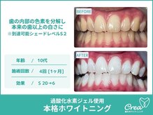 クレア(Crea)/【ホワイトニング症例写真】