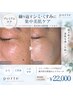  【プレミアム】繰り返すシミ・くすみに｜集中美肌ケア ￥22,000