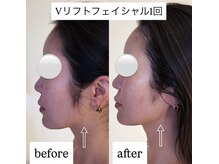 クラン(CLAN)/輪郭形成にVリフトフェイシャル