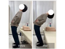 ナオル整体 三鷹院(NAORU整体)/20代男性施術事例【体幹後屈】