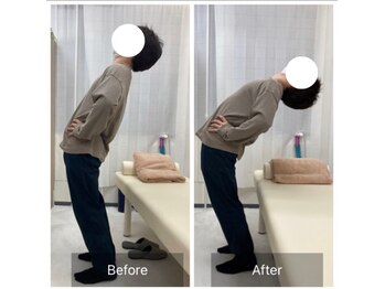 ナオル整体 三鷹院(NAORU整体)/20代男性施術事例【体幹後屈】