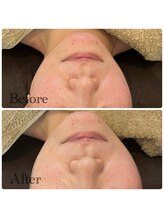 サロンドフェイス 木曽川店(Salon de Faith)/毛穴きゅっ！むくみスッキリ♪