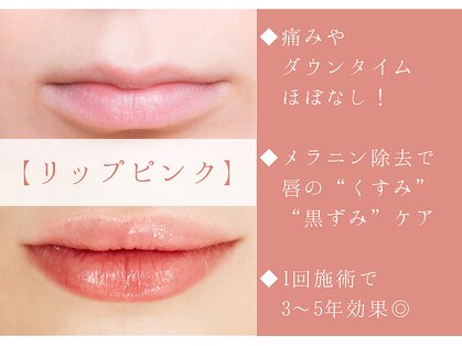 サロン レーヴェ(Salon LOWE)の写真