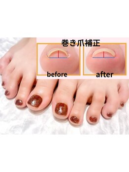 角質ケアができるサロン